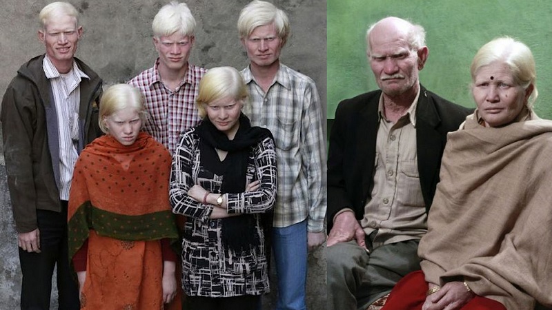 albinosi kolaz
